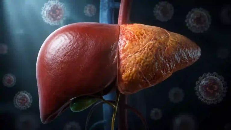 hepatitis b symptoms